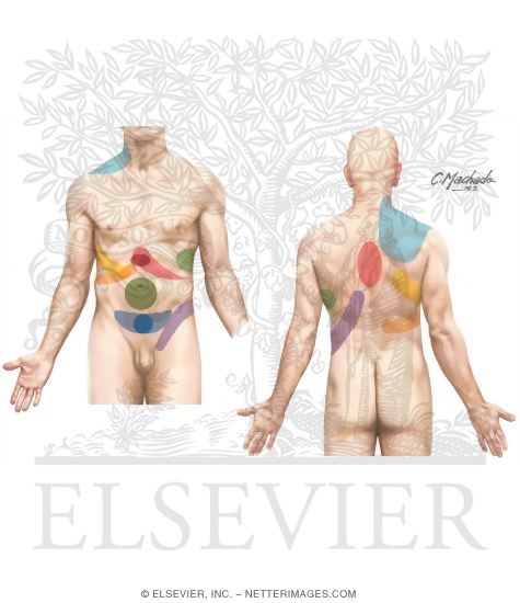 Visceral Referred Pain