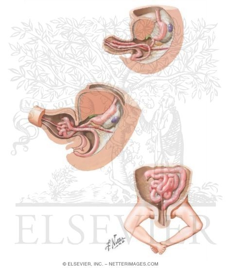 Embryology: Gut Tube Rotation