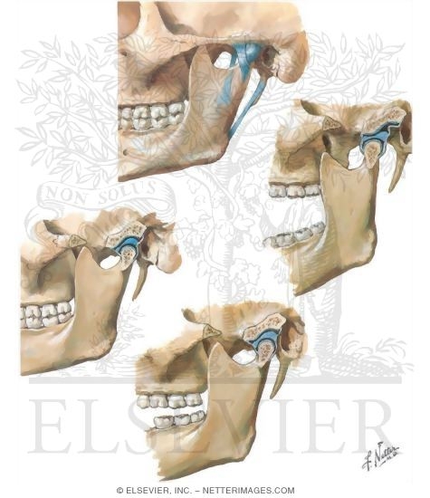 Skull: Temporomandibular Joint