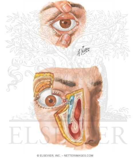 Watermarked preview of unlabeled image: Orbit: Eyelids and Lacrimal Apparatus