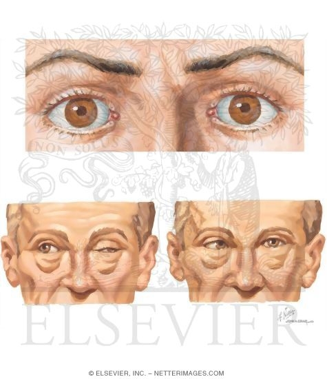 General Testing of Extraocular Muscles