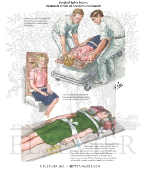 Watermarked preview of labeled image: Surgical Spine Injury: Treatment At Site of Accident