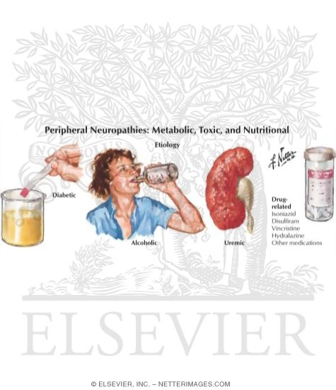 Watermarked preview of labeled image: Peripheral Neuropathies: Metabolic, Toxic and Nutritional