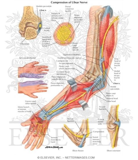 Watermarked preview of labeled image: Compression of Ulnar Nerve