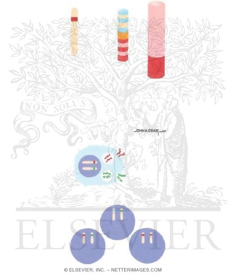 Watermarked preview of unlabeled image: Immunogenetics of Rheumatoid Arthritis