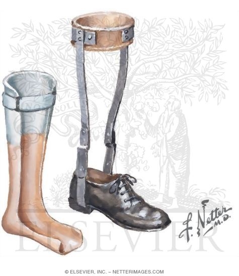Watermarked preview of unlabeled image: Orthotics