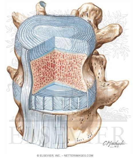 Watermarked preview of unlabeled image: Intervertebral Disk