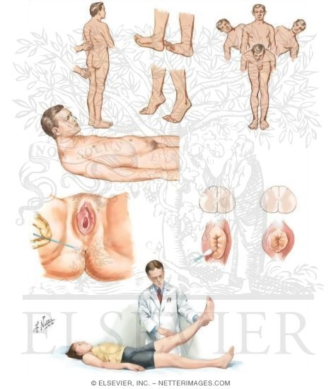 Watermarked preview of unlabeled image: Physical Examination of the Spine