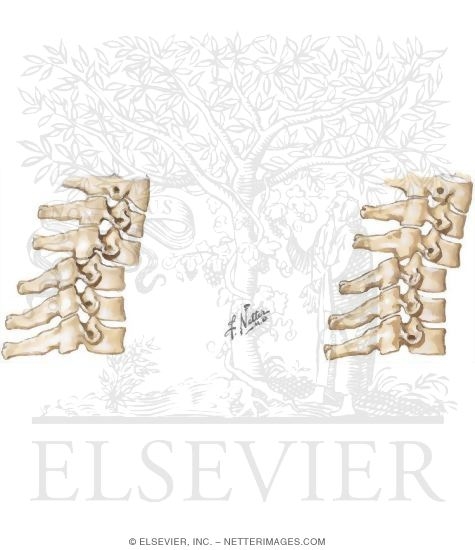Watermarked preview of unlabeled image: Radiographic Signs of Cervical Spine Instability