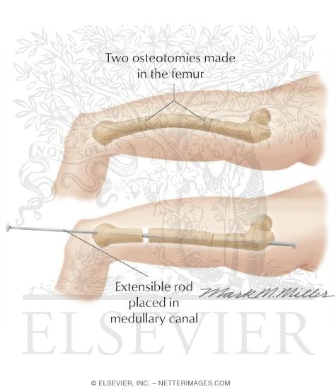 Watermarked preview of unlabeled image: Measurement of Flexion / Extension
