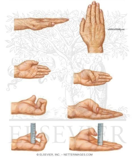 Measurement Of Wrist Motion And Finger Motion Lack Of Finger