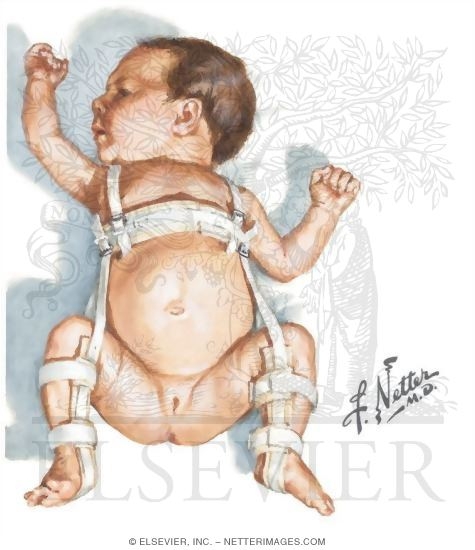 Watermarked preview of unlabeled image: Pavlik Harness
