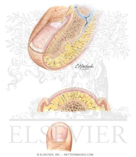 Watermarked preview of unlabeled image: Anatomy of the Toenail