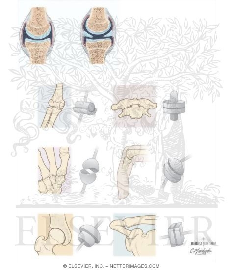 Watermarked preview of unlabeled image: Types of Joints