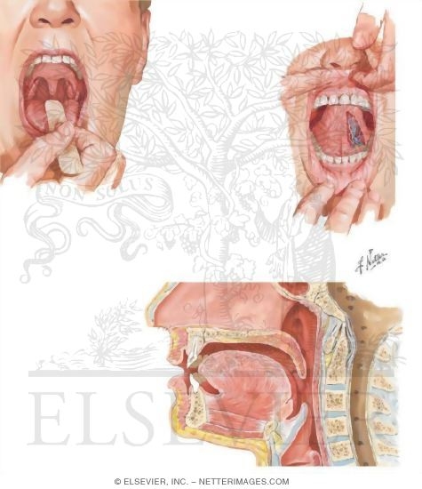 Watermarked preview of unlabeled image: Mouth