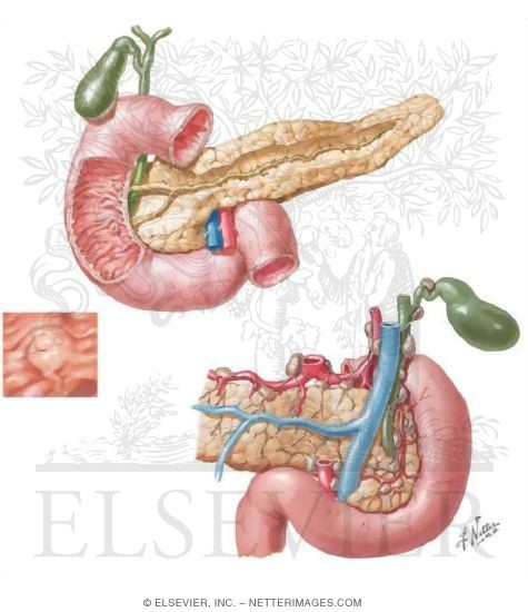 Watermarked preview of unlabeled image: Pancreas