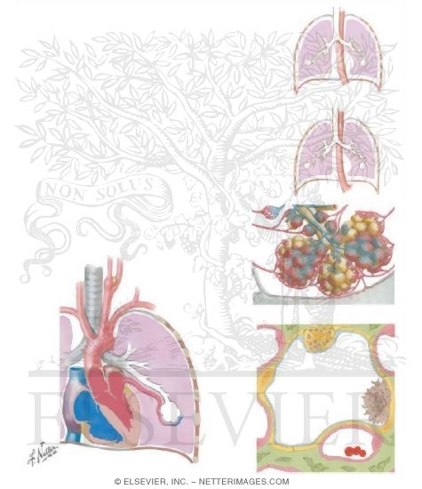 Watermarked preview of unlabeled image: Gas Exchange
