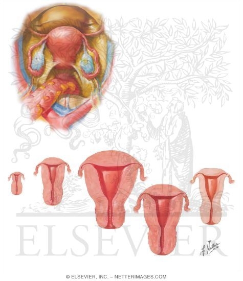 Watermarked preview of unlabeled image: Uterus and Vagina