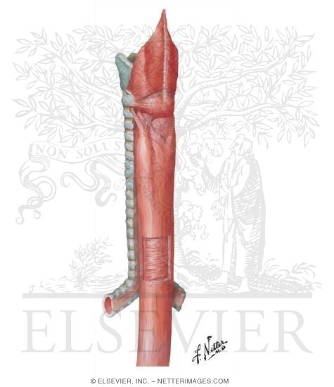 Watermarked preview of unlabeled image: Esophagus