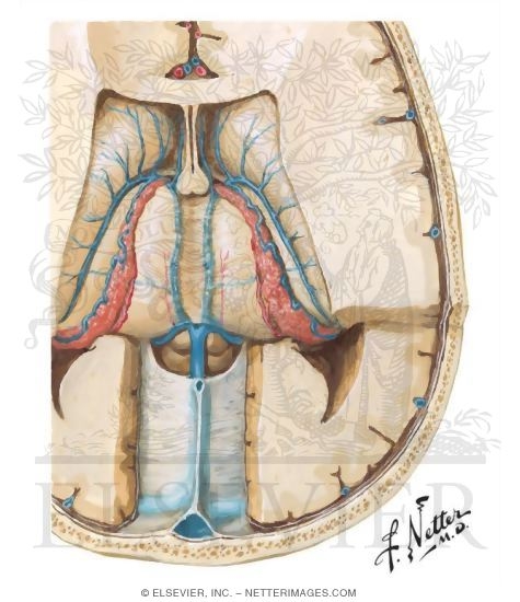 Deep Cerebral Veins - Dissection: Superior View