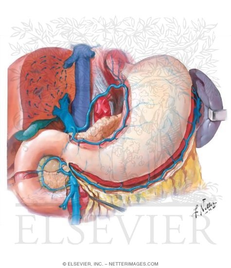 Watermarked preview of unlabeled image: Venous Drainage of Stomach, Duodenum, and Spleen