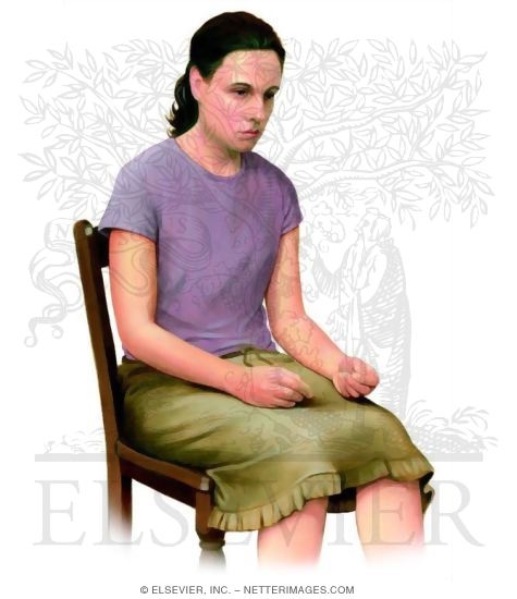 Watermarked preview of unlabeled image: Epilepsy
