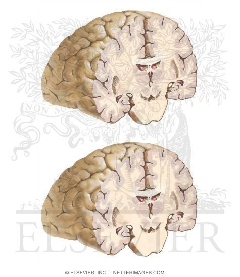 Brain