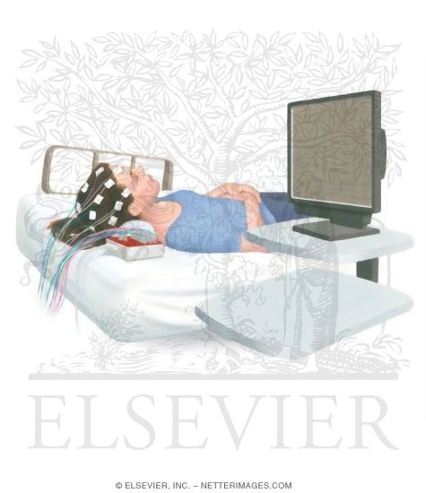 Watermarked preview of unlabeled image: Epilepsy Testing