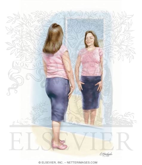 Watermarked preview of unlabeled image: Obesity