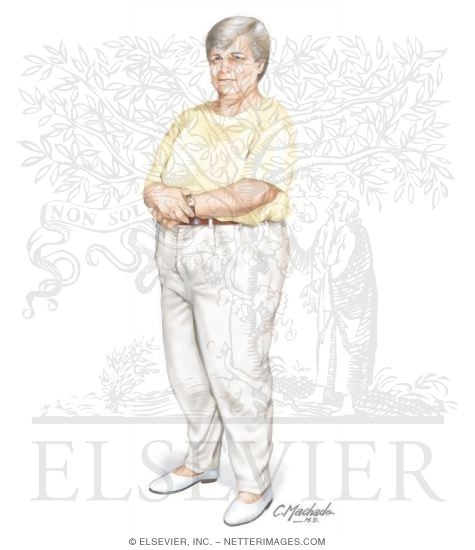 Watermarked preview of unlabeled image: Obesity