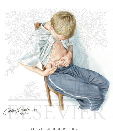 Watermarked preview of unlabeled image: Insulin Injection