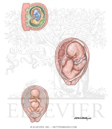 Watermarked preview of unlabeled image: Oligohydramnios