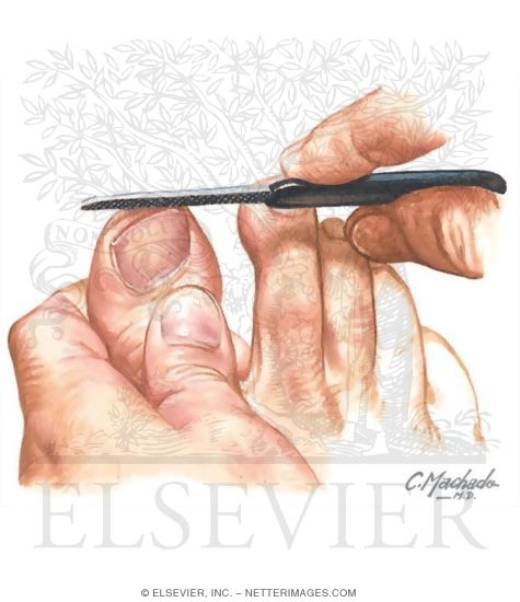 Watermarked preview of unlabeled image: Foot
