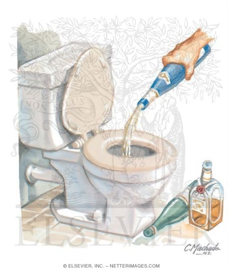 Watermarked preview of unlabeled image: Alcoholism