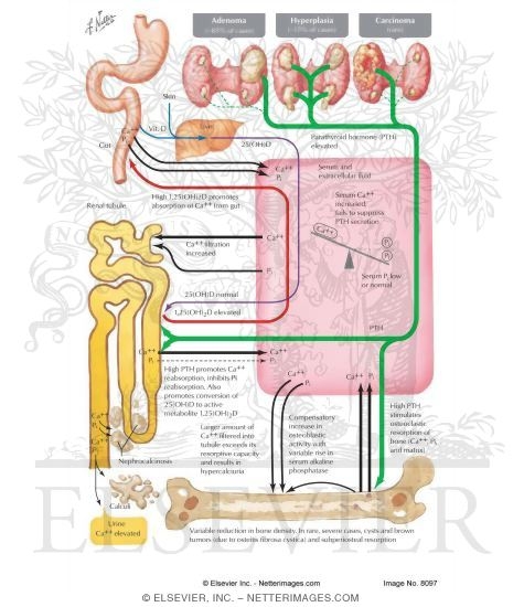 Pathophysiology of Primary Hyperparathyroidism