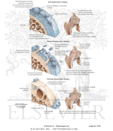 Watermarked preview of labeled image: Histopathology of Osteoarthritis