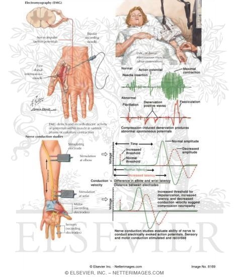 Electrodiagnostic Studies of Nerves