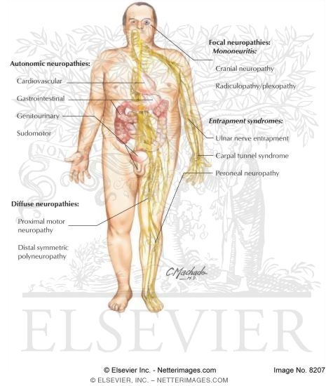 Watermarked preview of labeled image: Visible Man: Organs Affected By Diabetic Neuropathy