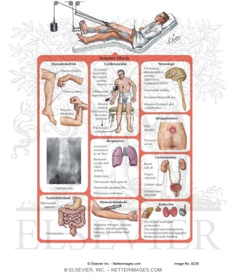 Watermarked preview of labeled image: Immobilization