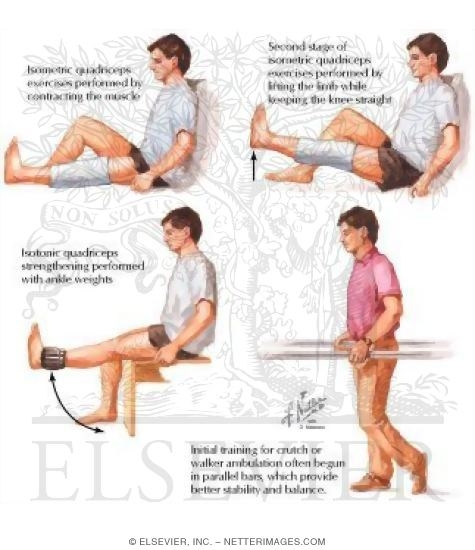 Isotonic deals quadriceps exercises