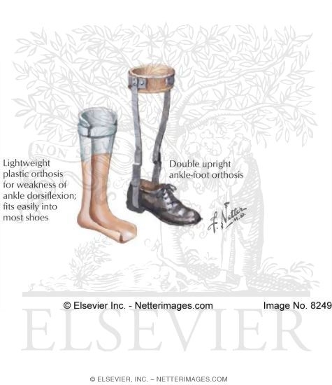 Watermarked preview of labeled image: Orthotics