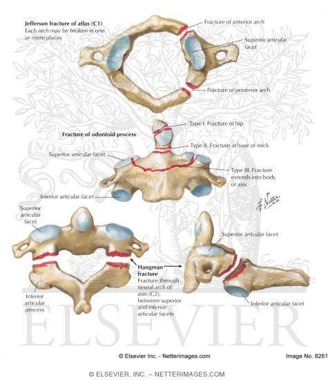 Cervical Fractures