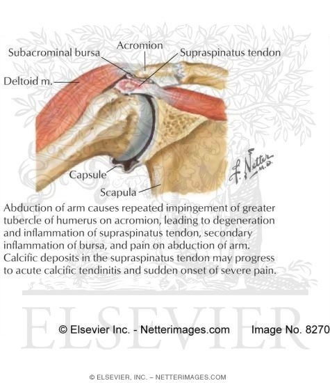 Watermarked preview of labeled image: Rotator Cuff Disease