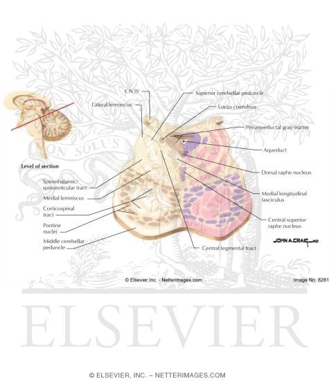Watermarked preview of labeled image: Pons-Midbrain Junction - Level of CN IV and Locus Coeruleus