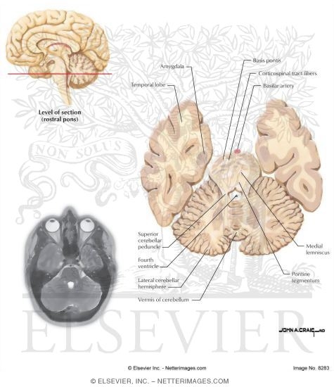 Watermarked preview of labeled image: Horizontal Sections Through the Forebrain: Rostral Pons