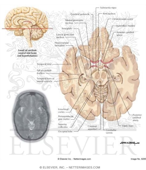 Horizontal Sections Through the Forebrain: Rostral Midbrain and Hypothalamus