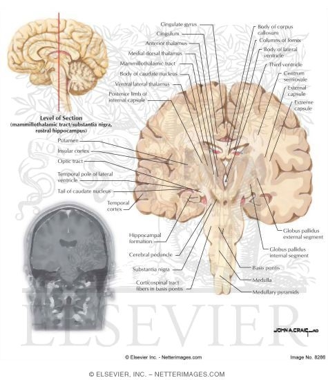 Coronal Sections Through the Forebrain: Mammillothalamic Tract/Substantia Nigra, Rostral Hippocampus