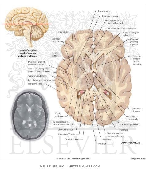 Head of Caudate and Midthalamus