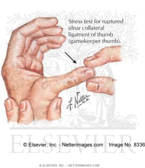 Gamekeeper Thumb