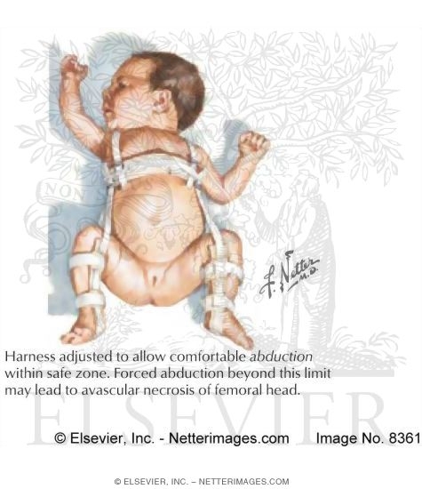 Watermarked preview of labeled image: Pavlik Harness